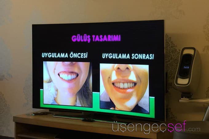dr-huseyin-tirman-gulus-tasarimi