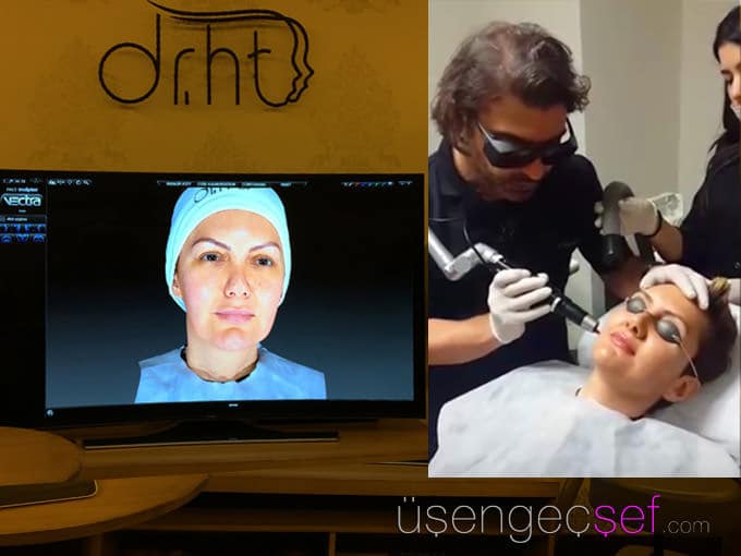 dr-huseyin-tirman-picosil-leke-tedavisi