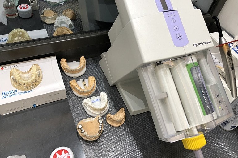 dentcraft porselen dis disci tavsiye kadikoy 1