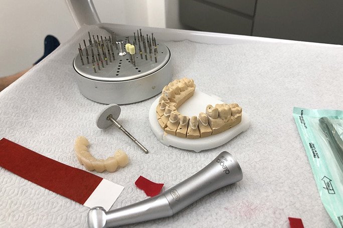 dentcraft porselen dis disci tavsiye kadikoy